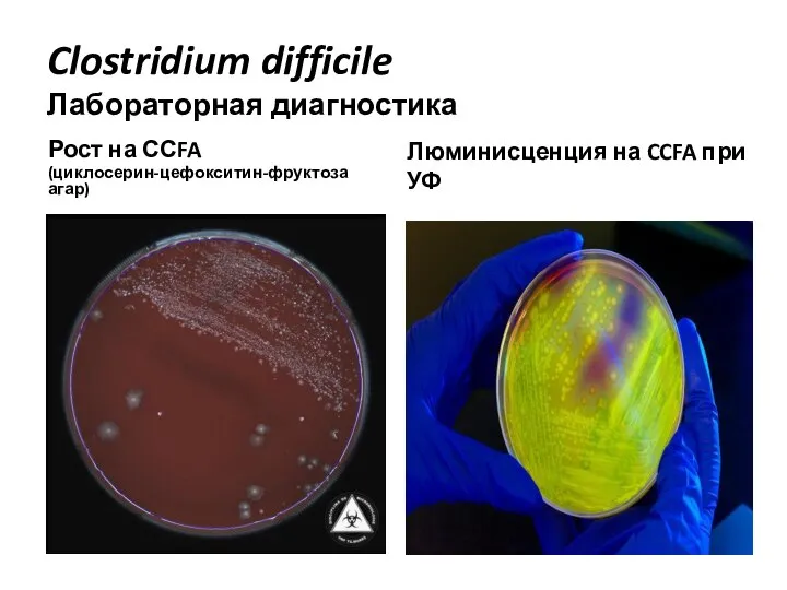 Clostridium difficile Лабораторная диагностика Рост на ССFA (циклосерин-цефокситин-фруктоза агар) Люминисценция на CCFA при УФ