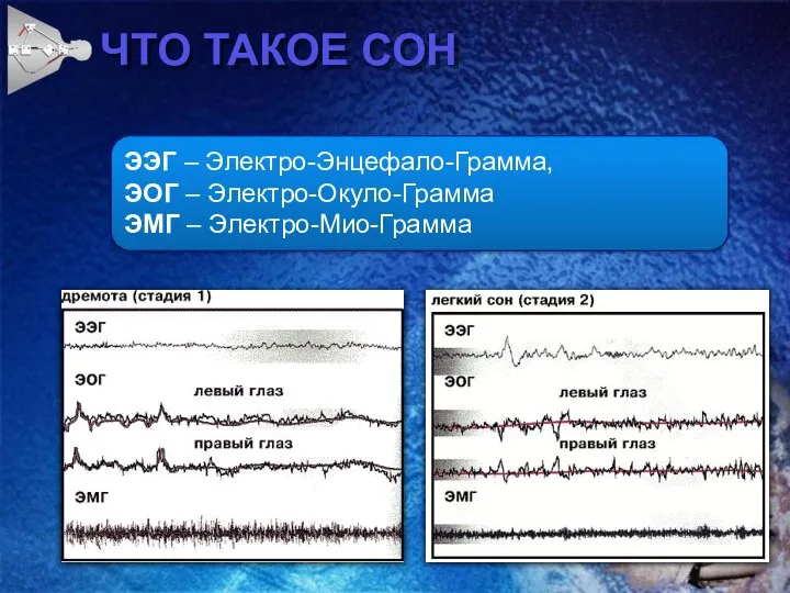 ЧТО ТАКОЕ СОН ЭЭГ – Электро-Энцефало-Грамма, ЭОГ – Электро-Окуло-Грамма ЭМГ – Электро-Мио-Грамма