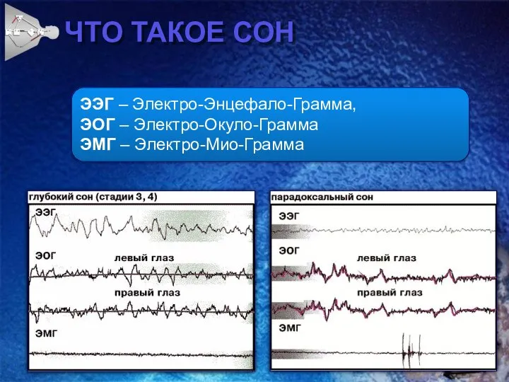 ЧТО ТАКОЕ СОН ЭЭГ – Электро-Энцефало-Грамма, ЭОГ – Электро-Окуло-Грамма ЭМГ – Электро-Мио-Грамма