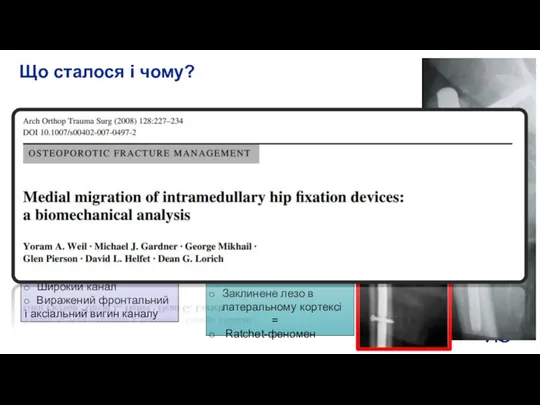 Що сталося і чому? Фактори перелому Нестабільний перелом Фізіологічний варус Остеопороз Широкий
