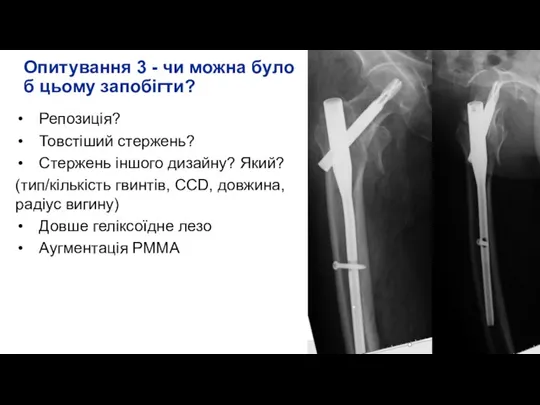 Опитування 3 - чи можна було б цьому запобігти? Репозиція? Товстіший стержень?