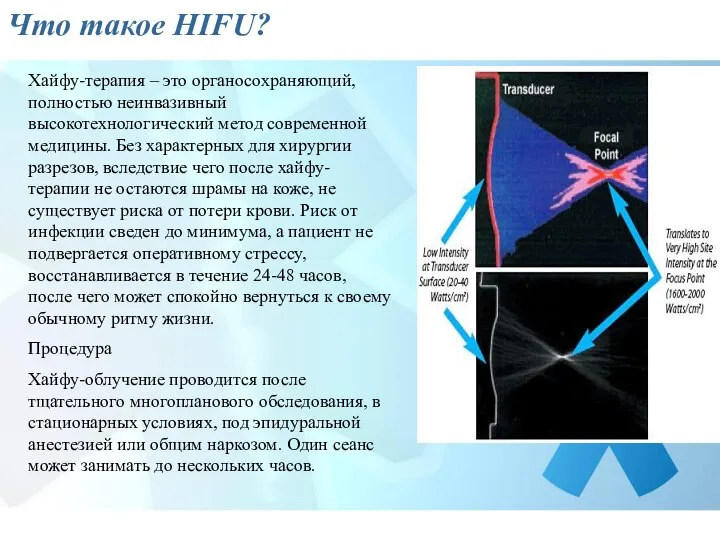 Что такое HIFU? Хайфу-терапия – это органосохраняющий, полностью неинвазивный высокотехнологический метод современной