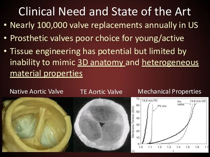 Clinical Need and State of the Art Nearly 100,000 valve replacements annually