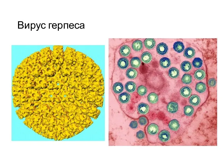 Вирус герпеса