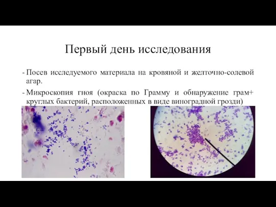 Первый день исследования Посев исследуемого материала на кровяной и желточно-солевой агар. Микроскопия