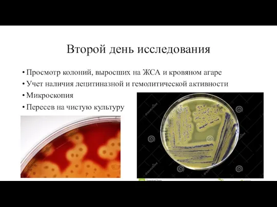 Второй день исследования Просмотр колоний, выросших на ЖСА и кровяном агаре Учет