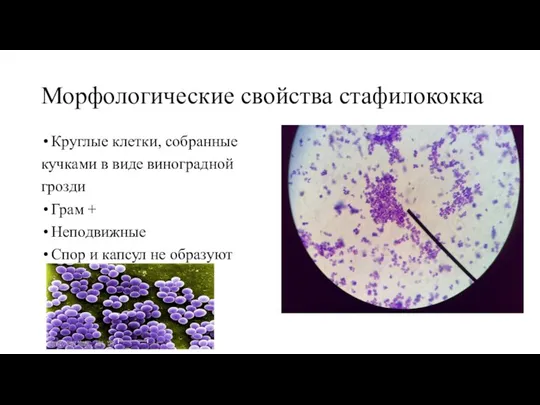 Морфологические свойства стафилококка Круглые клетки, собранные кучками в виде виноградной грозди Грам