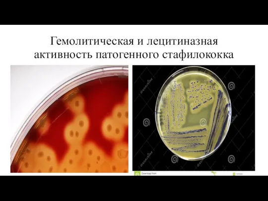 Гемолитическая и лецитиназная активность патогенного стафилококка