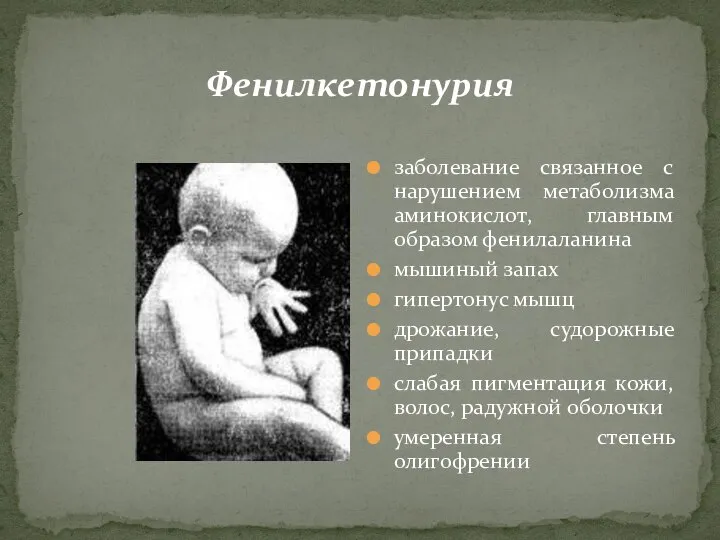 Фенилкетонурия заболевание связанное с нарушением метаболизма аминокислот, главным образом фенилаланина мышиный запах