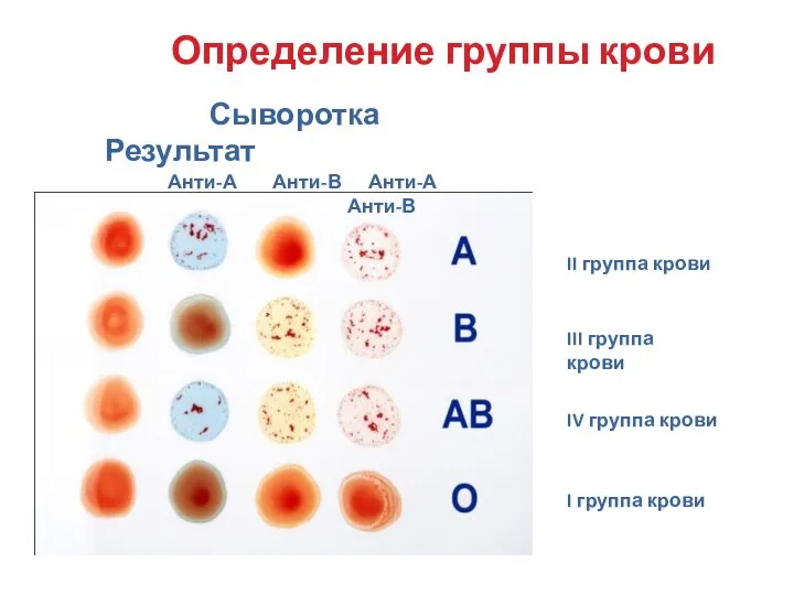 II группа крови III группа крови IV группа крови I группа крови