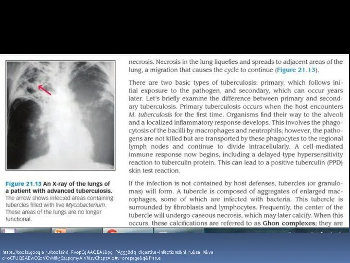 https://books.google.ru/books?id=Rv0pCgAAQBAJ&pg=PA555&dq=digestive+infections&hl=ru&sa=X&ved=0CFUQ6AEwCGoVChMIk56s4pqmyAIVhI1yCh2p7AIo#v=onepage&q&f=true