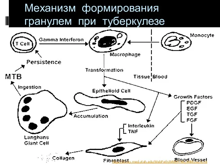 Механизм формирования гранулем при туберкулезе http://library.med.utah.edu/WebPath/IMMHTML/IMM104.html