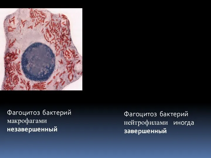 Фагоцитоз бактерий макрофагами незавершенный Фагоцитоз бактерий нейтрофилами иногда завершенный