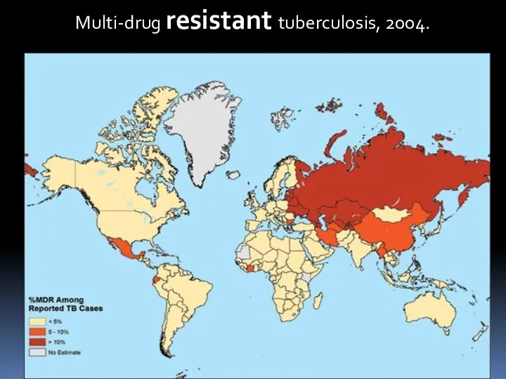 Multi-drug resistant tuberculosis, 2004.