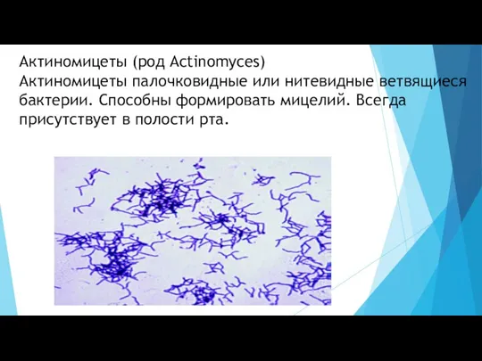Актиномицеты (род Actinomyces) Актиномицеты палочковидные или нитевидные ветвящиеся бактерии. Способны формировать мицелий.