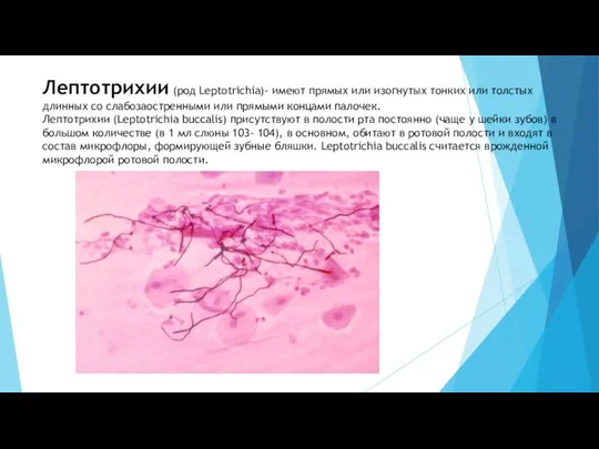 Лептотрихии (род Leptotrichia)- имеют прямых или изогнутых тонких или толстых длинных cо