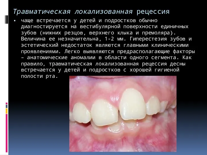 Травматическая локализованная рецессия чаще встречается у детей и подростков обычно диагностируется на