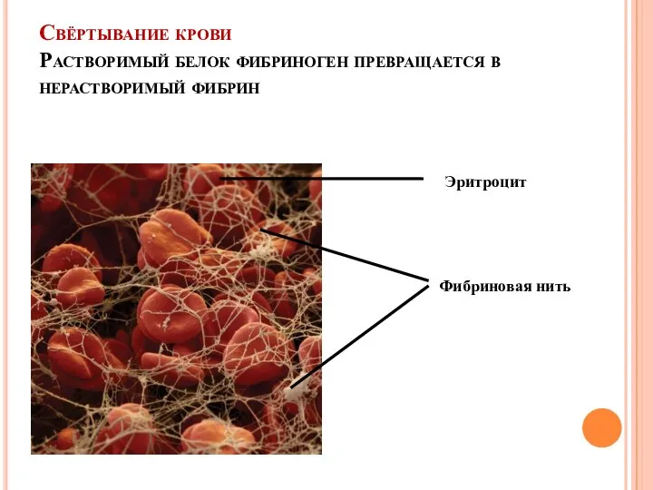 Свёртывание крови Растворимый белок фибриноген превращается в нерастворимый фибрин Эритроцит Фибриновая нить