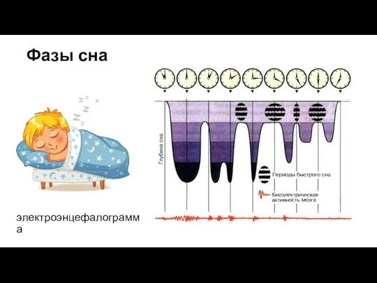 Фазы сна электроэнцефалограмма