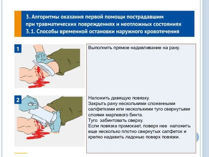 Выполнить прямое надавливание на рану. Наложить давящую повязку. Закрыть рану несколькими сложенными