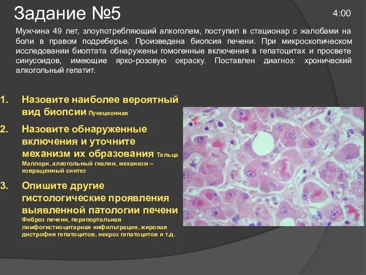 Задание №5 4:00 Мужчина 49 лет, злоупотребляющий алкоголем, поступил в стационар с