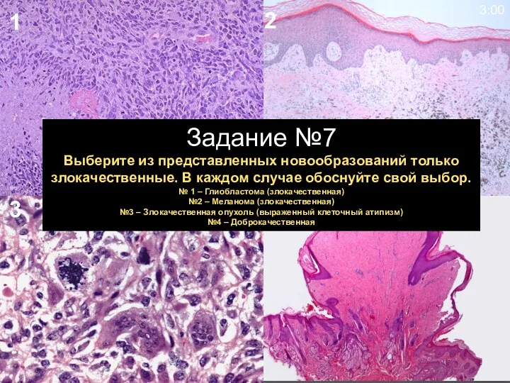 1 2 4 3 3:00 Задание №7 Выберите из представленных новообразований только