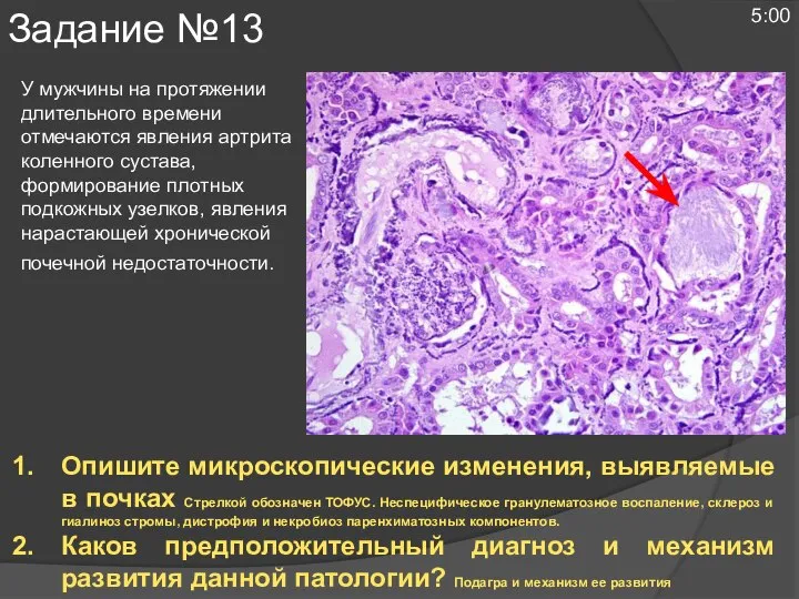 У мужчины на протяжении длительного времени отмечаются явления артрита коленного сустава, формирование