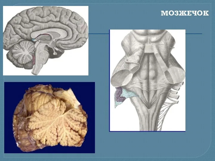 МОЗЖЕЧОК