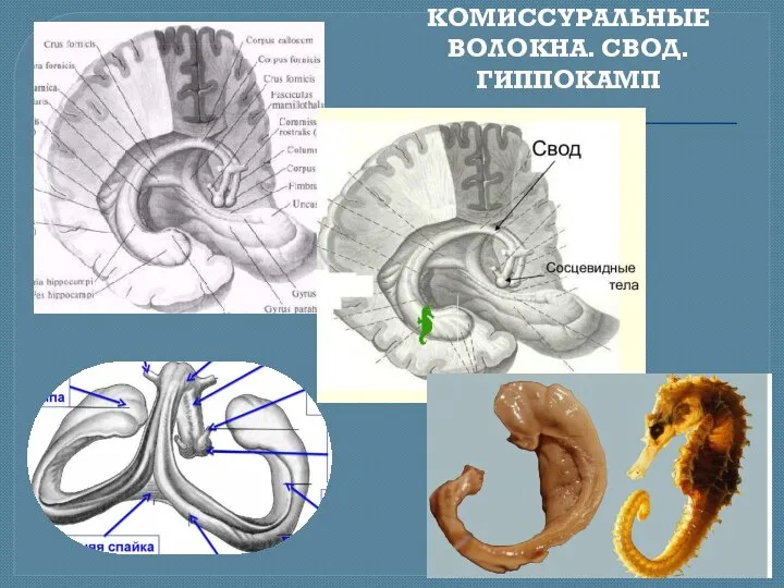 КОМИССУРАЛЬНЫЕ ВОЛОКНА. СВОД. ГИППОКАМП