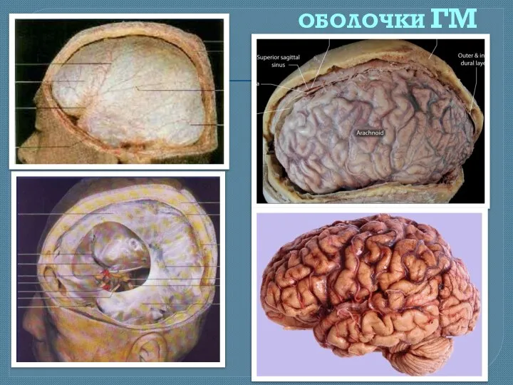 ОБОЛОЧКИ ГМ