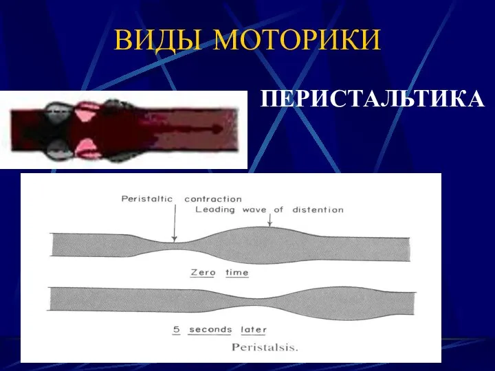 ВИДЫ МОТОРИКИ ПЕРИСТАЛЬТИКА