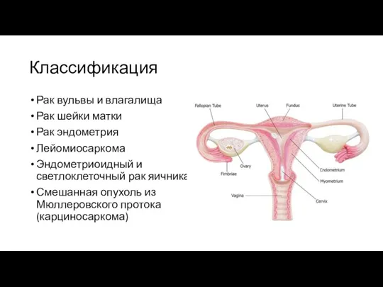 Классификация Рак вульвы и влагалища Рак шейки матки Рак эндометрия Лейомиосаркома Эндометриоидный