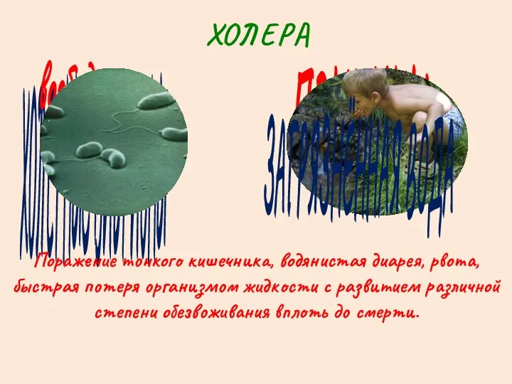 ХОЛЕРА ХОЛЕРНЫЕ ВИБРИОНЫ возбудители ПРИЧИНЫ Поражение тонкого кишечника, водянистая диарея, рвота, быстрая