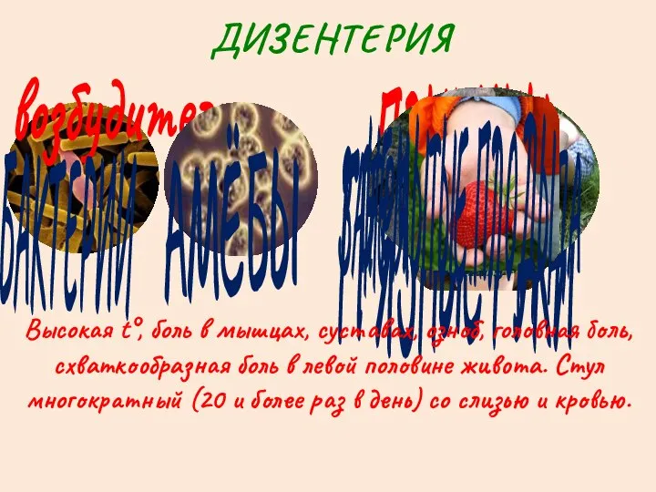 ДИЗЕНТЕРИЯ возбудители БАКТЕРИИ АМЁБЫ ПРИЧИНЫ ГРЯЗНЫЕ РУКИ ЗАГРЯЗНЁННАЯ ВОДА Высокая t°, боль