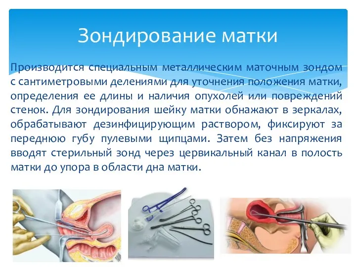 Производится специальным металлическим маточным зондом с сантиметровыми делениями для уточнения положения матки,