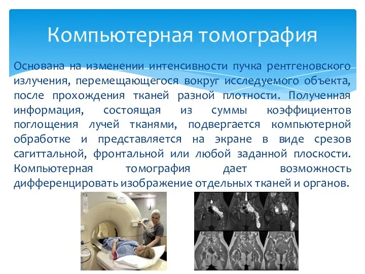 Основана на изменении интенсивности пучка рентгеновского излучения, перемещающегося вокруг исследуемого объекта, после