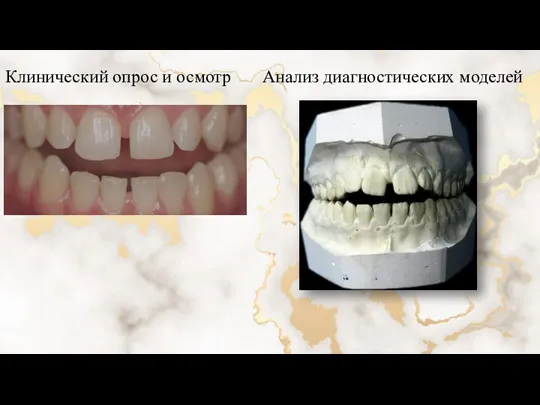 Клинический опрос и осмотр Анализ диагностических моделей