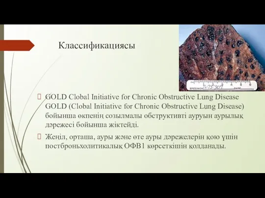 Классификациясы GOLD Clobal Initiative for Chronic Obstructive Lung Disease GOLD (Clobal Initiative