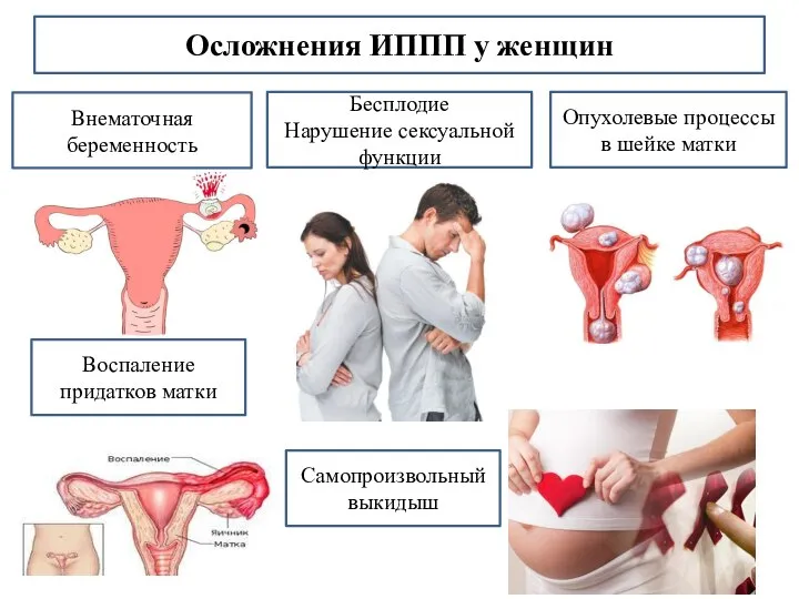 Осложнения ИППП у женщин Бесплодие Нарушение сексуальной функции Опухолевые процессы в шейке
