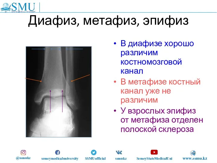 Диафиз, метафиз, эпифиз В диафизе хорошо различим костномозговой канал В метафизе костный