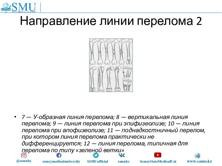 Направление линии перелома 2 7 — У-образная линия перелома; 8 — вертикальная