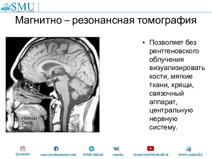 Магнитно – резонансная томография Позволяет без рентгеновского облучения визуализировать кости, мягкие ткани,