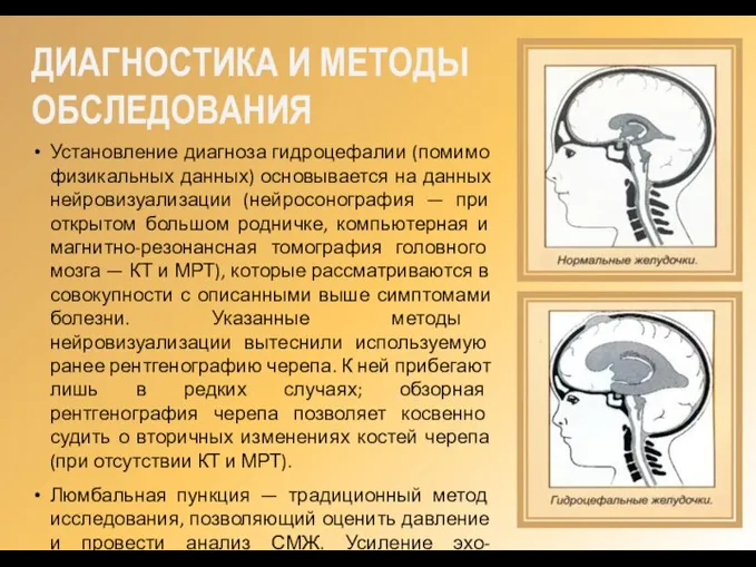 ДИАГНОСТИКА И МЕТОДЫ ОБСЛЕДОВАНИЯ Установление диагноза гидроцефалии (помимо физикальных данных) основывается на