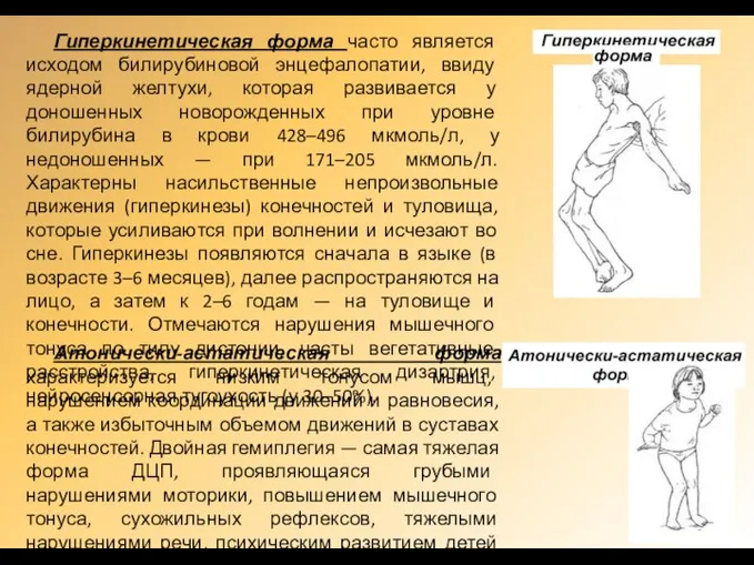 Гиперкинетическая форма часто является исходом билирубиновой энцефалопатии, ввиду ядерной желтухи, которая развивается