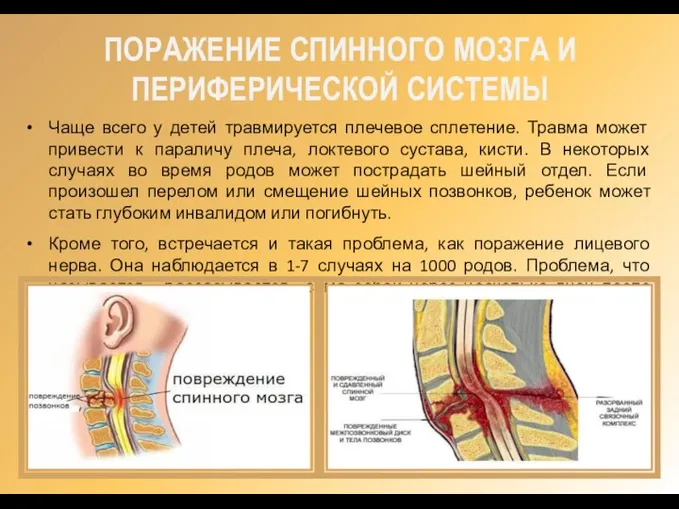 ПОРАЖЕНИЕ СПИННОГО МОЗГА И ПЕРИФЕРИЧЕСКОЙ СИСТЕМЫ Чаще всего у детей травмируется плечевое