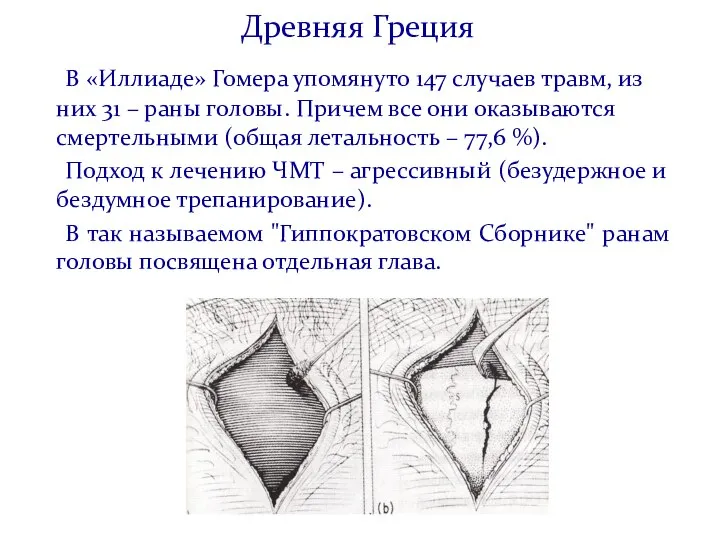 Древняя Греция В «Иллиаде» Гомера упомянуто 147 случаев травм, из них 31