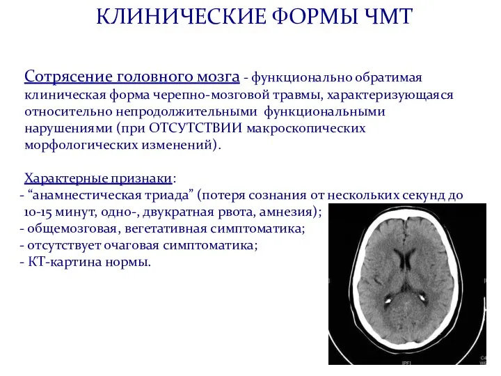 КЛИНИЧЕСКИЕ ФОРМЫ ЧМТ Сотрясение головного мозга - функционально обратимая клиническая форма черепно-мозговой