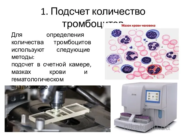 1. Подсчет количество тромбоцитов Для определения количества тромбоцитов используют следующие методы: подсчет