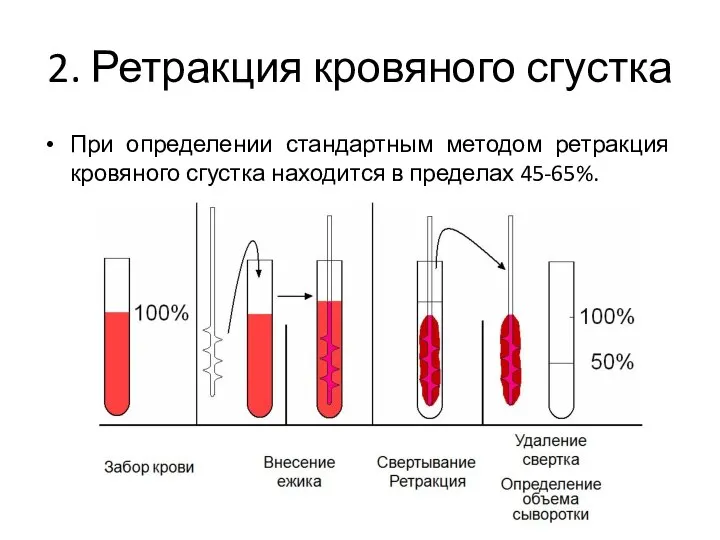 2. Ретракция кровяного сгустка При определении стандартным методом ретракция кровяного сгустка находится в пределах 45-65%.