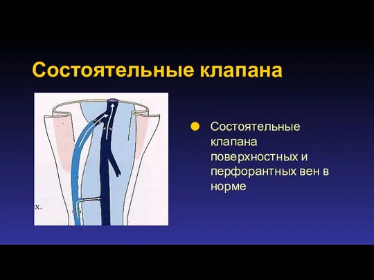 Состоятельные клапана Состоятельные клапана поверхностных и перфорантных вен в норме